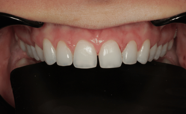 Before - Creffield Lodge Dental Practice