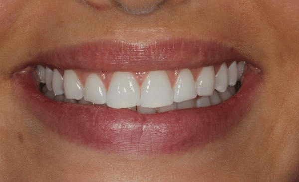 Before - Creffield Lodge Dental Practice