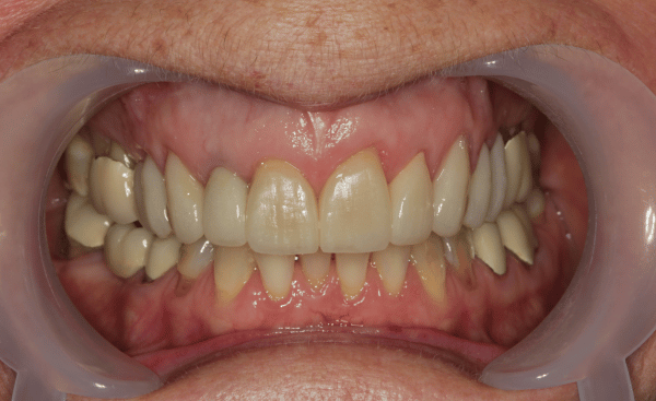 After - Creffield Lodge Dental Practice