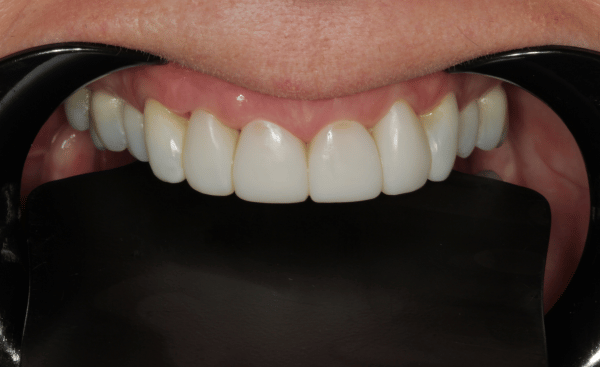 After - Creffield Lodge Dental Practice