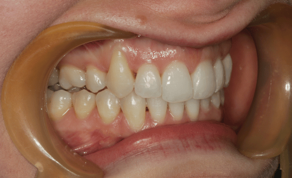 After - Creffield Lodge Dental Practice